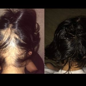 Rejuva advanced hair growth butter